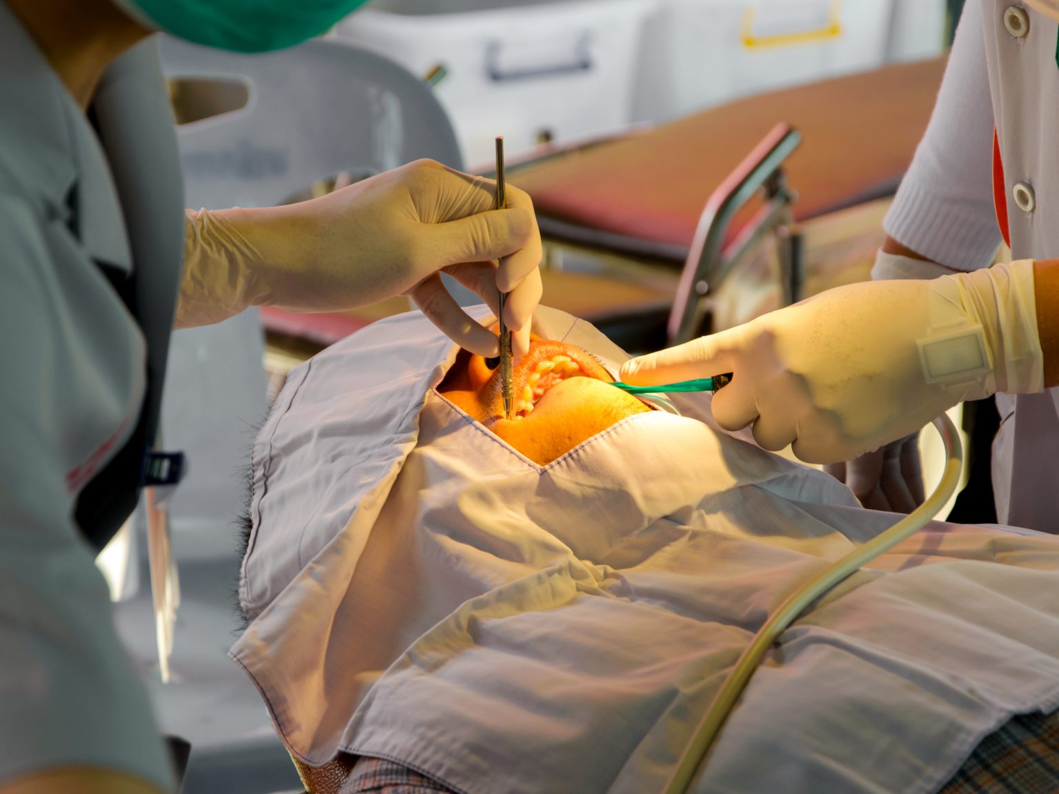 What is Oral Prophylaxis?